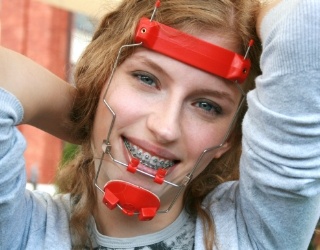Young woman with headgear orthodontic appliance
