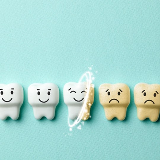 Cartoon teeth gradually turning white 