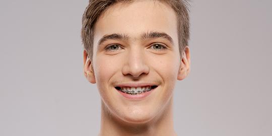 smiling teen who knows various factors that affect the cost of traditional braces in Atlanta