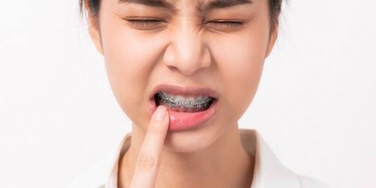 Woman in pain due to cut caused by braces