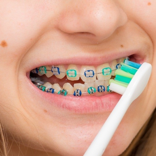 Patient brushing teeth to prevent orthodontic emergencies
