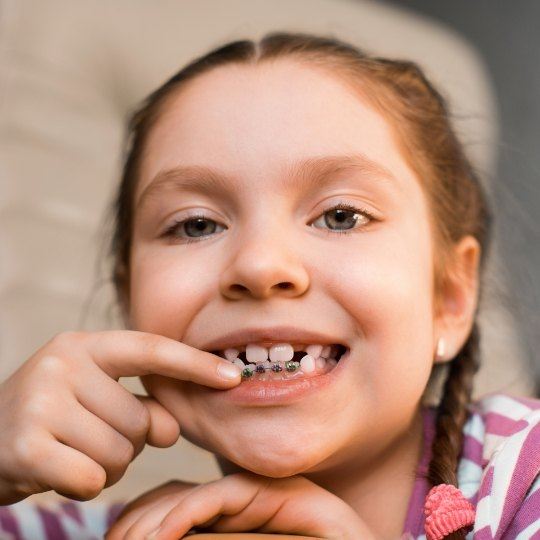 Young girl with phase one pediatric orthodontics pointing to her smile