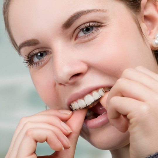 Patient placing a retainer