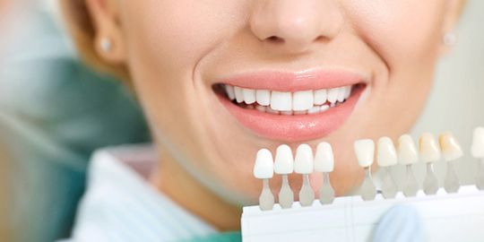 Patient smiling next to different shades of enamel